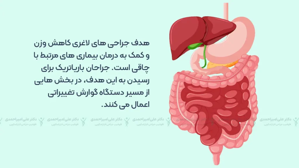 هدف عمل لاغری چیست (اینفوگرافی)