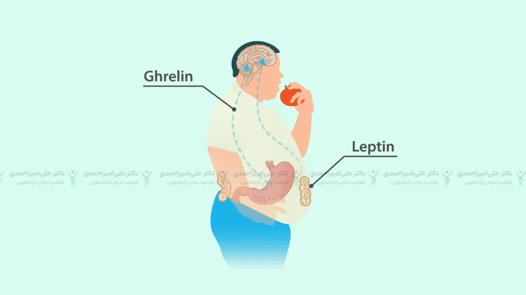 تاثیر چاقی بر هورمون های گرسنگی و تنبلی تخمدان