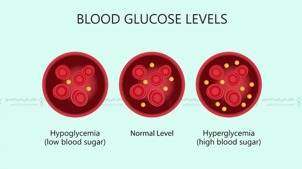 سطح قند خون در بیماری دیابت نوع 2