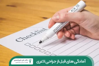 اقدامات قبل از جراحی لاغری شاخص