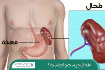 طحال چیست و کجاست؟