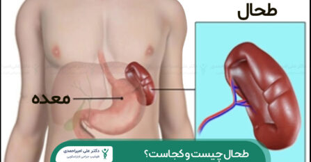 طحال چیست و کجاست؟